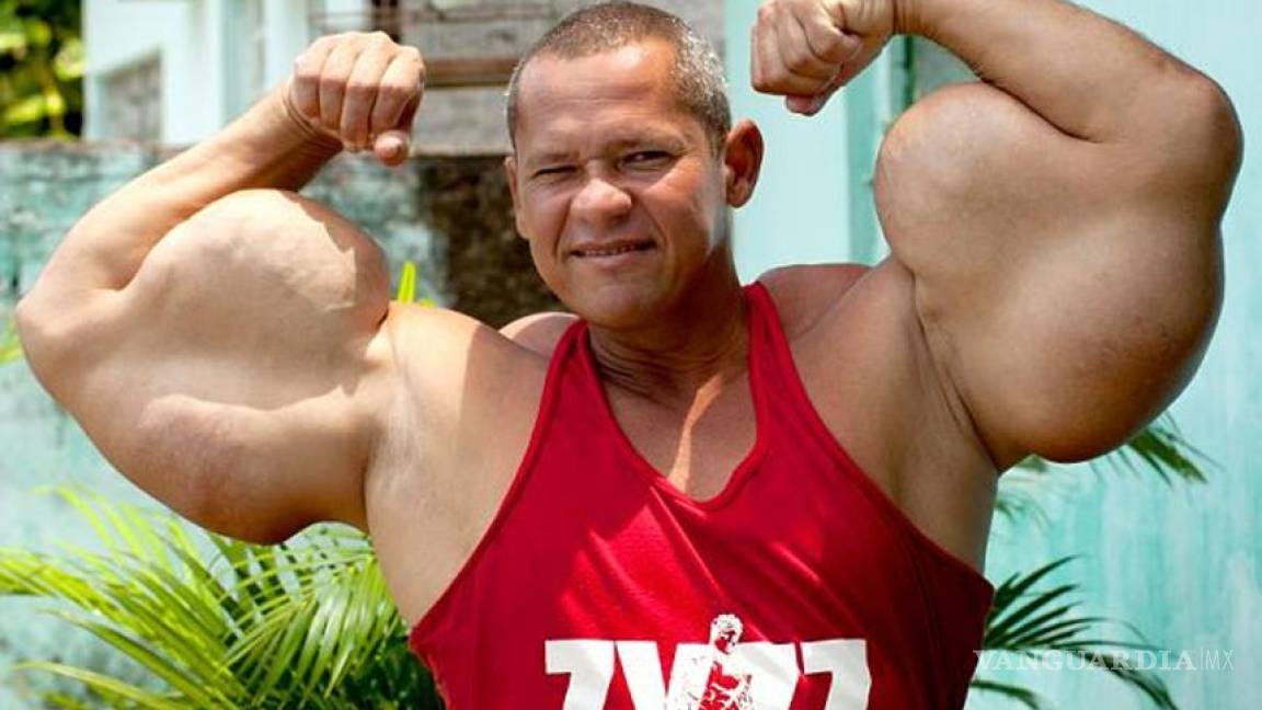 Arlindo de Souza, el hombre con los bíceps más grandes del mundo