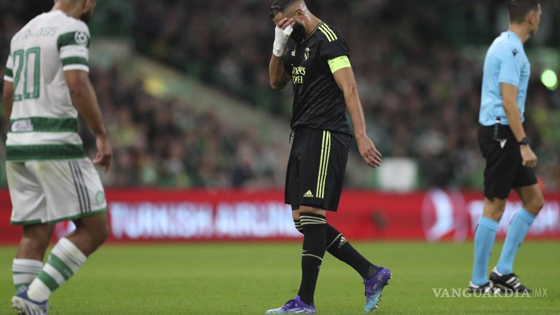 Karim Benzema fuera de peligro tras encuentro ante el Celtic
