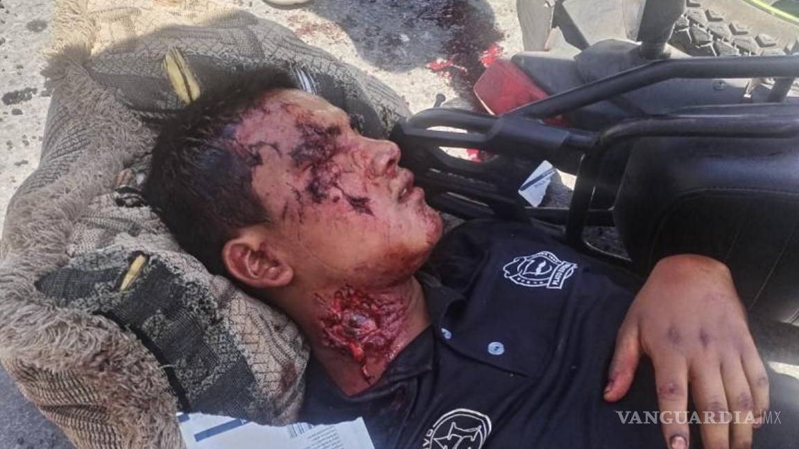 $!El joven terminó con graves heridas. Fue trasladado en una ambulancia de la Cruz Roja.