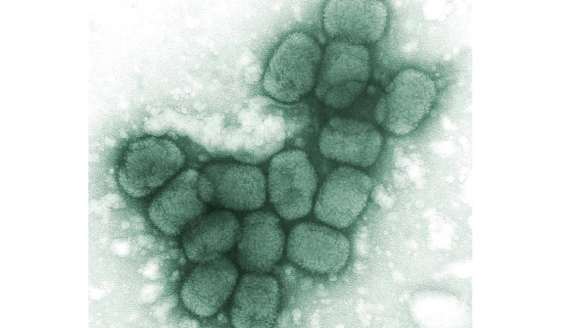 Aprueban en EU medicamento contra la viruela