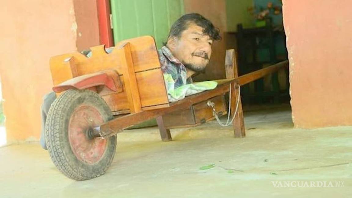 $!Su esposa lo abandonó, no tiene piernas ni brazos, aún así crió a sus hijas