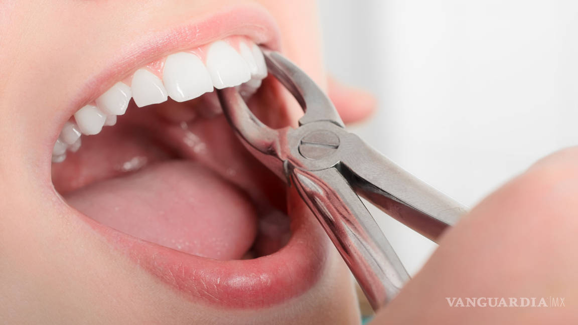 Alerta director de odontología de la UAdeC contra clínicas dentales ‘patito’