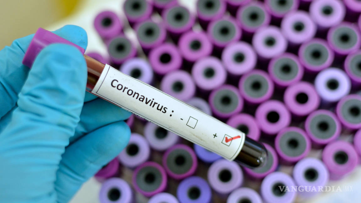 Vacuna contra el coronavirus, lista en 18 meses: OMS