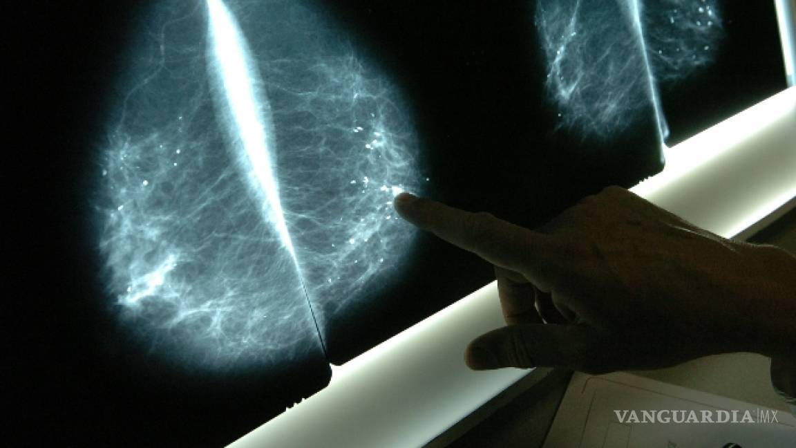 Nueva tecnología buscará hacer las mamografías menos dolorosas
