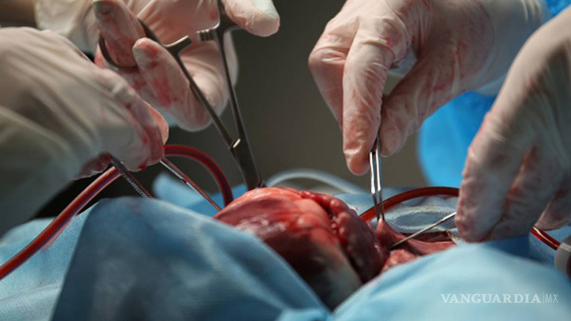Brasil rompe récord de donadores de órganos
