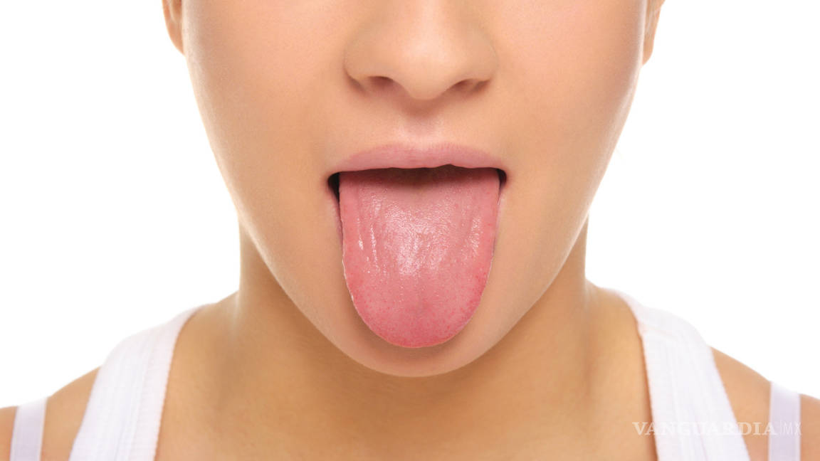 Tonsilolitos: Qué son y cómo afectan tu salud