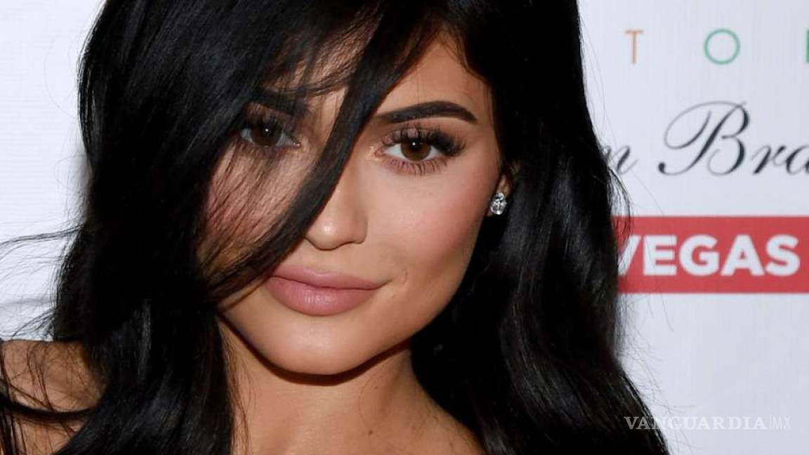Kylie Jenner se quitó el relleno de los labios... y así luce ahora
