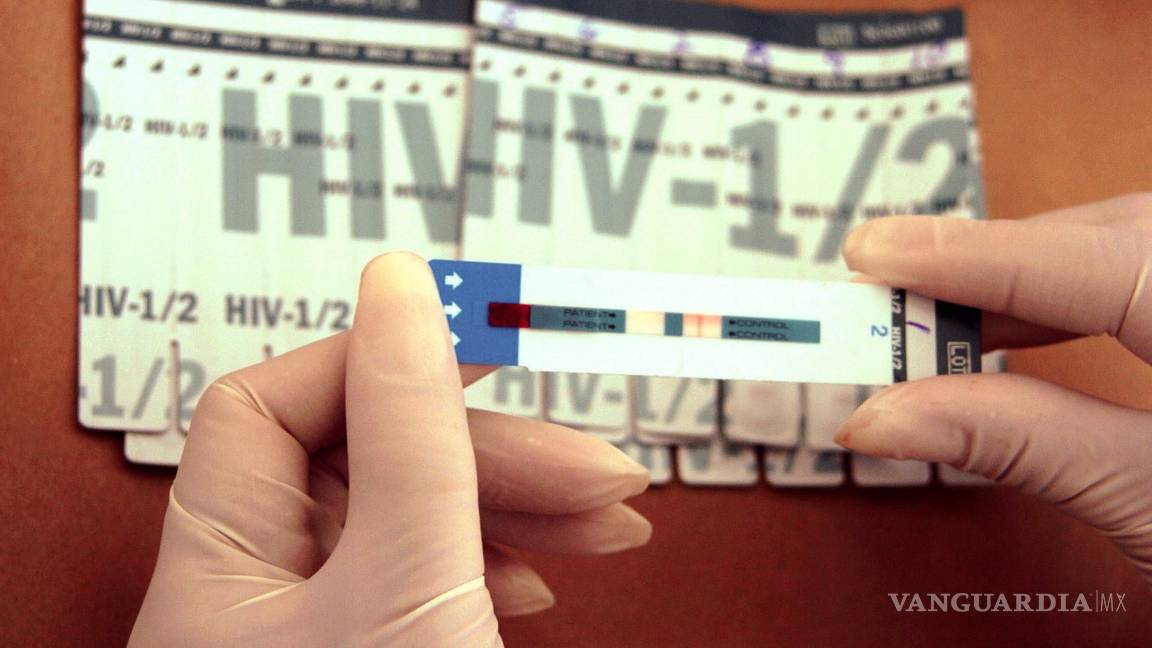 $!Un médico sostiene una prueba de detección del VIH.