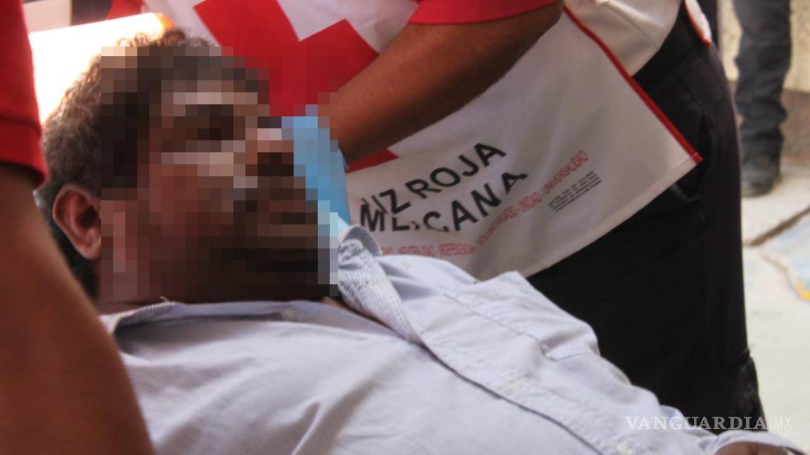 Coahuila: llega inconsciente a hospital por mordedura de serpiente; hombre se habría aplicado torniquete previamente
