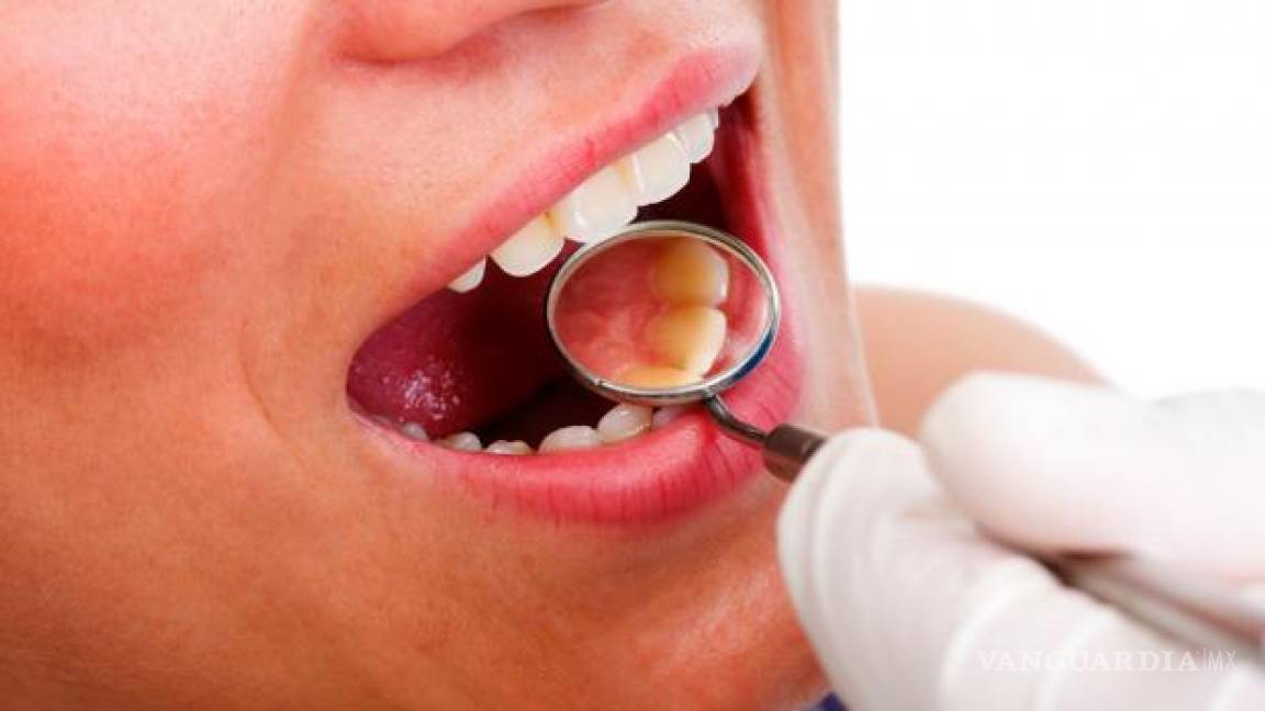 Síntomas del cáncer oral: Uno de los más mortales