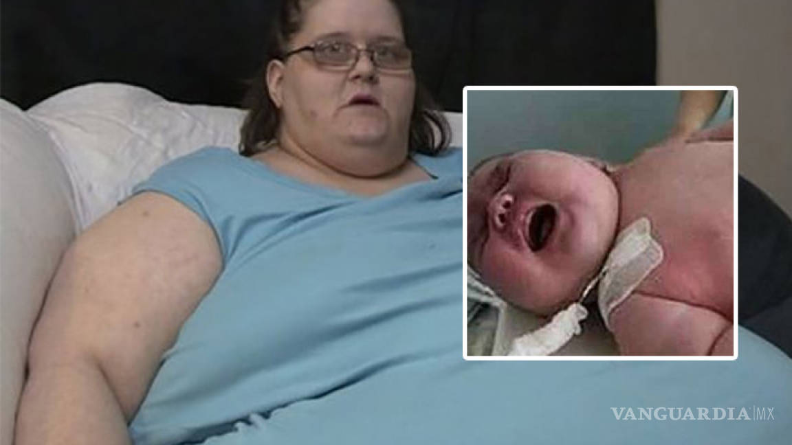 Mujer de 272 kilos da a luz a un bebé de 18 kilos, es el más grande de la historia