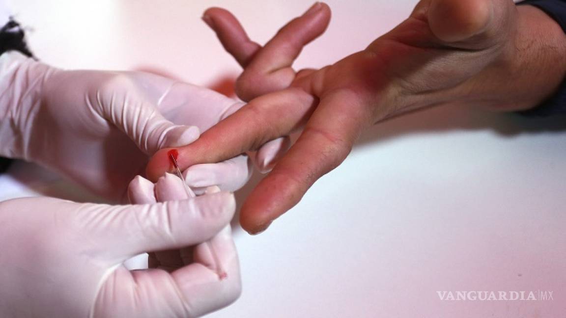 178 mil 310 mexicanos viven con VIH y Sida