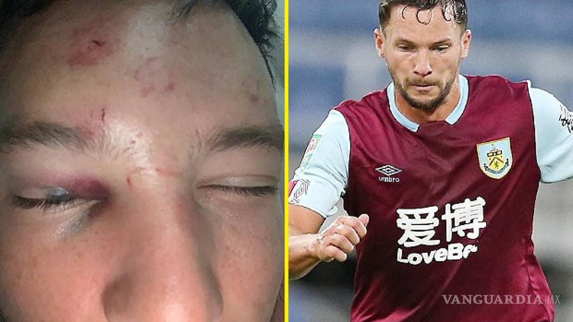 Jugador de la Premier League termina herido afuera de un bar