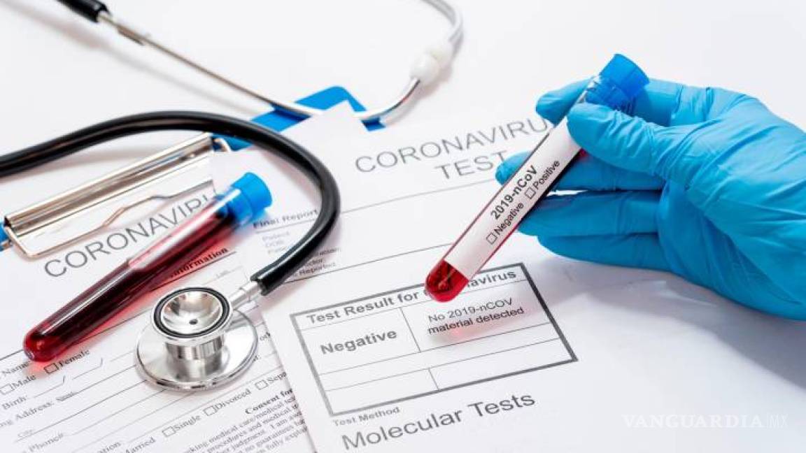 Coahuila mantiene seguimiento a 12 casos sospechosos de coronavirus; no hay nuevos pacientes confirmados