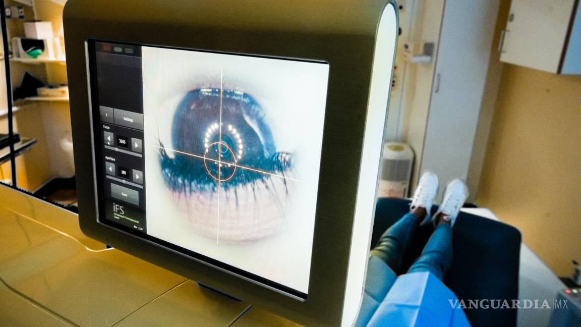 $!La interfaz del láser de femtosegundo se utiliza para cortar y remodelar la córnea.