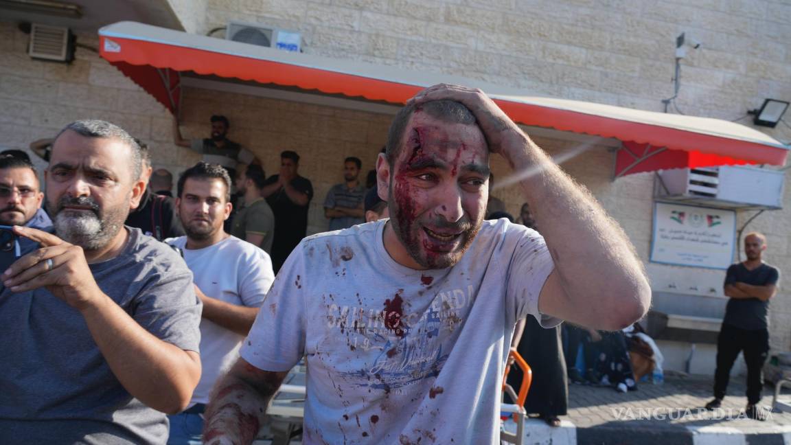 $!Un palestino herido en ataques aéreos israelíes llega al hospital de Al Aqsa en la ciudad de Der el-Balah, en la Franja de Gaza.