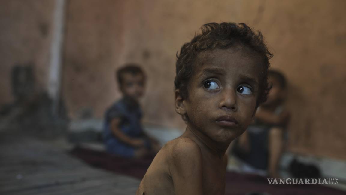 $!Yazan Abu Ful, que padece desnutrición en el campamento de refugiados Shati. El PMA señala que casi 100,000 mujeres y niños necesitan urgentemente tratamiento para la desnutrición.