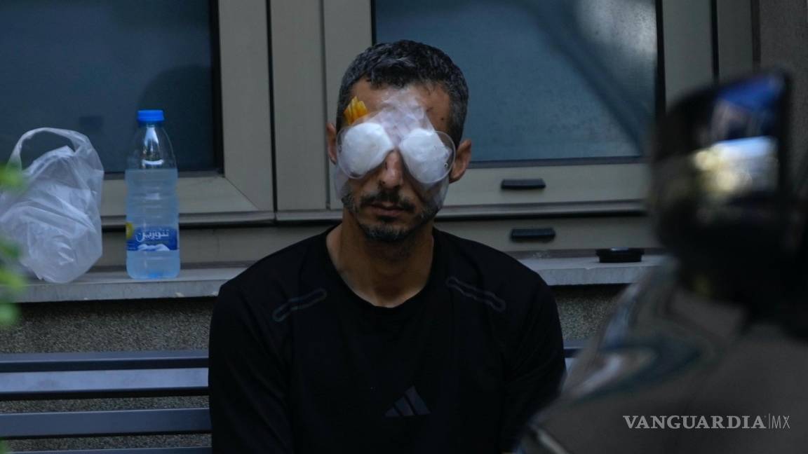 $!Un hombre que resultó herido en la explosión de uno de los dispositivos portátiles se sienta afuera del hospital Eye Specialist, en Beirut, Líbano.