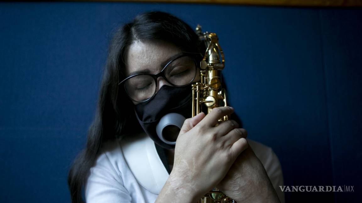 El saxofón, aliento de María Elena Ríos, artista mexicana atacada con ácido
