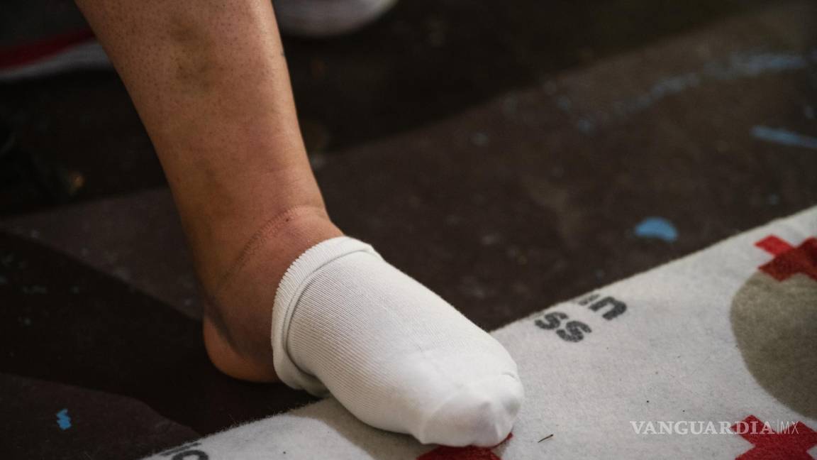 $!El pie de Rosmarie Cepeda, que se rompió al caer mientras descendía del muro fronterizo en El Paso, Texas.