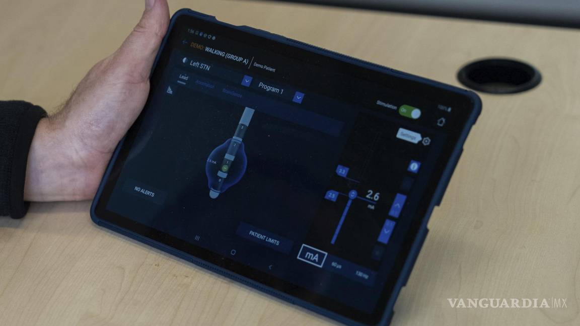 $!El psiquiatra Dr. Martijn Figee muestra una tableta utilizada para programar la cantidad de estimulación eléctrica cerebral profunda administrada a los pacientes.