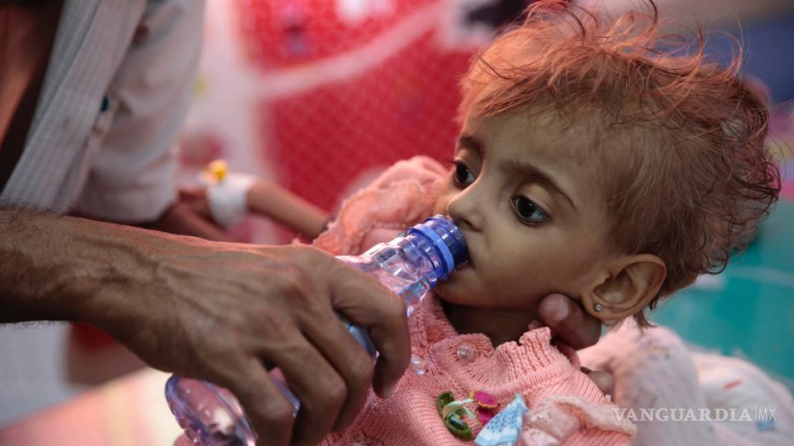 Según Save the Children, el hambre habría matado a 85 mil niños en Yemen