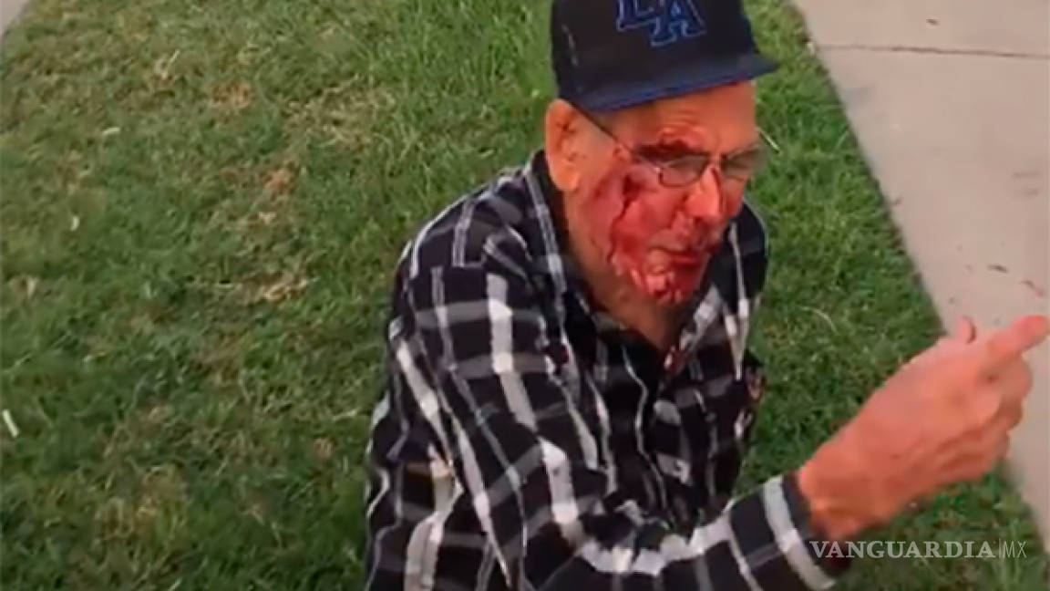 Anciano mexicano es golpeado en EU; le gritan ‘regresa a tu país’, estaba de visita