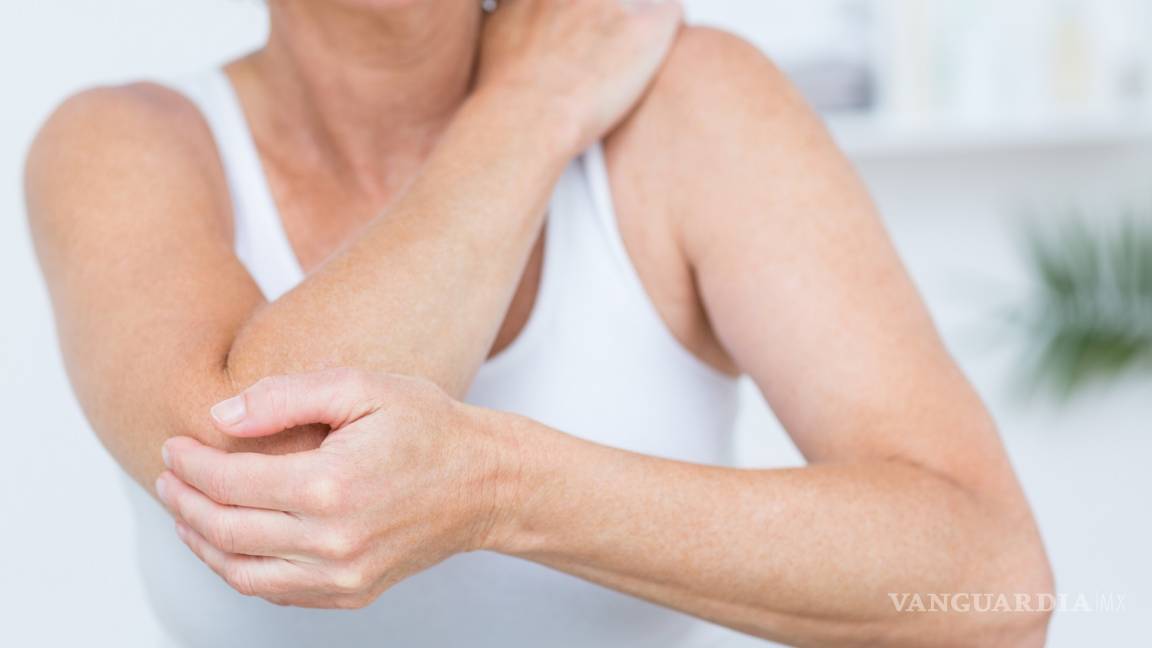 Mujeres son más propensas a sufrir de Lupus