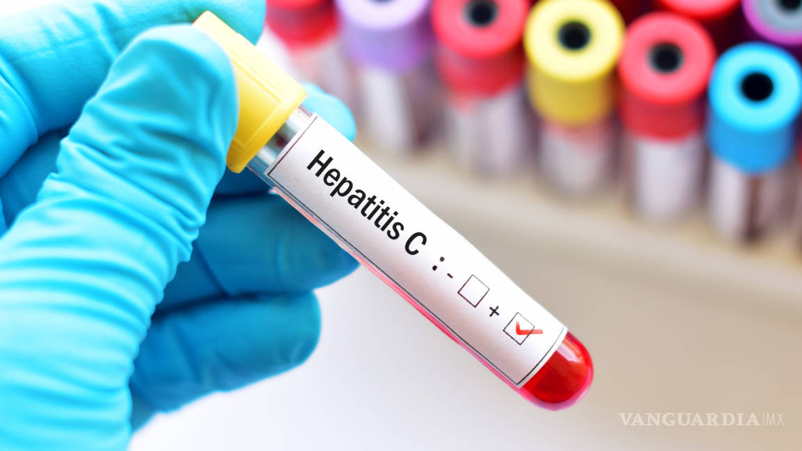 Aumentan casos de hepatitis C en Coahuila