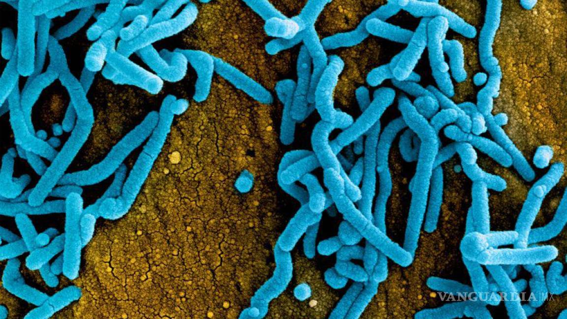 Brote del virus de Marburgo en Ghana, tan infeccioso y mortal como el ébola