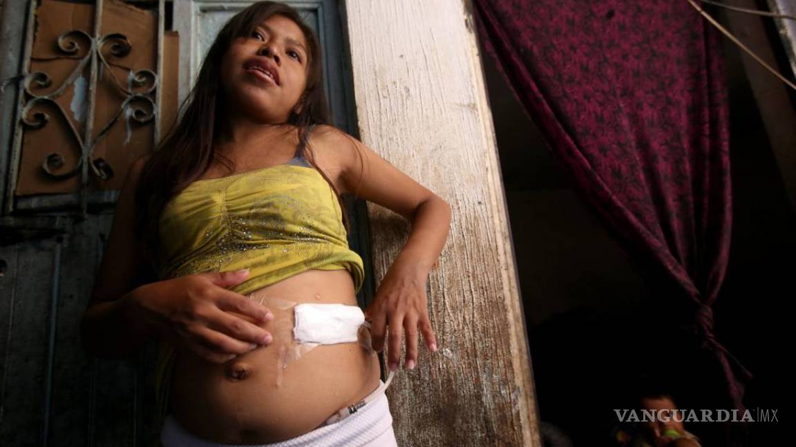 $!San Pedro Itzicán, un pueblo en México que muere de insuficiencia renal