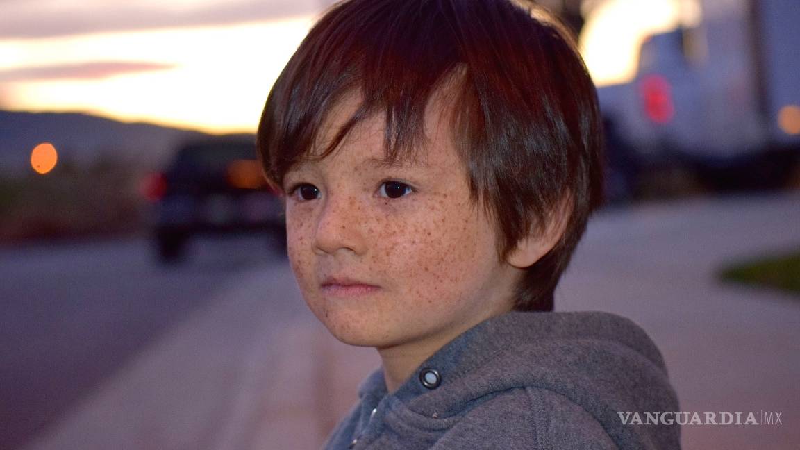 $!Oliver Kei, el 'hijo de la luna': es tan alérgico al sol que debe usar un traje especial todos los días