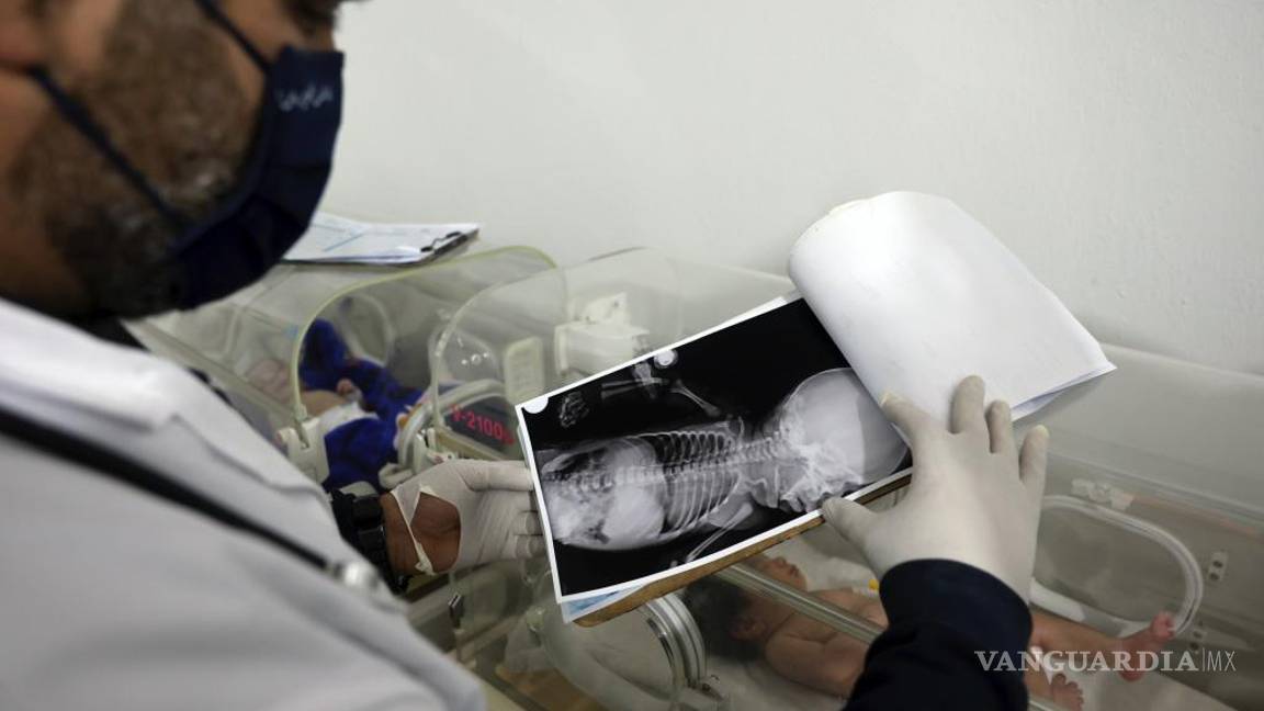 $!El doctor Hani Maarouf observa una radiografía de una niña que nació bajo los escombros causados por un terremoto que azotó a Siria y Turquía.