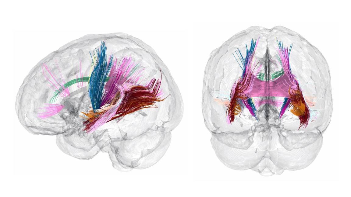 Surgen nuevas claves para determinar si el embarazo cambia el cerebro