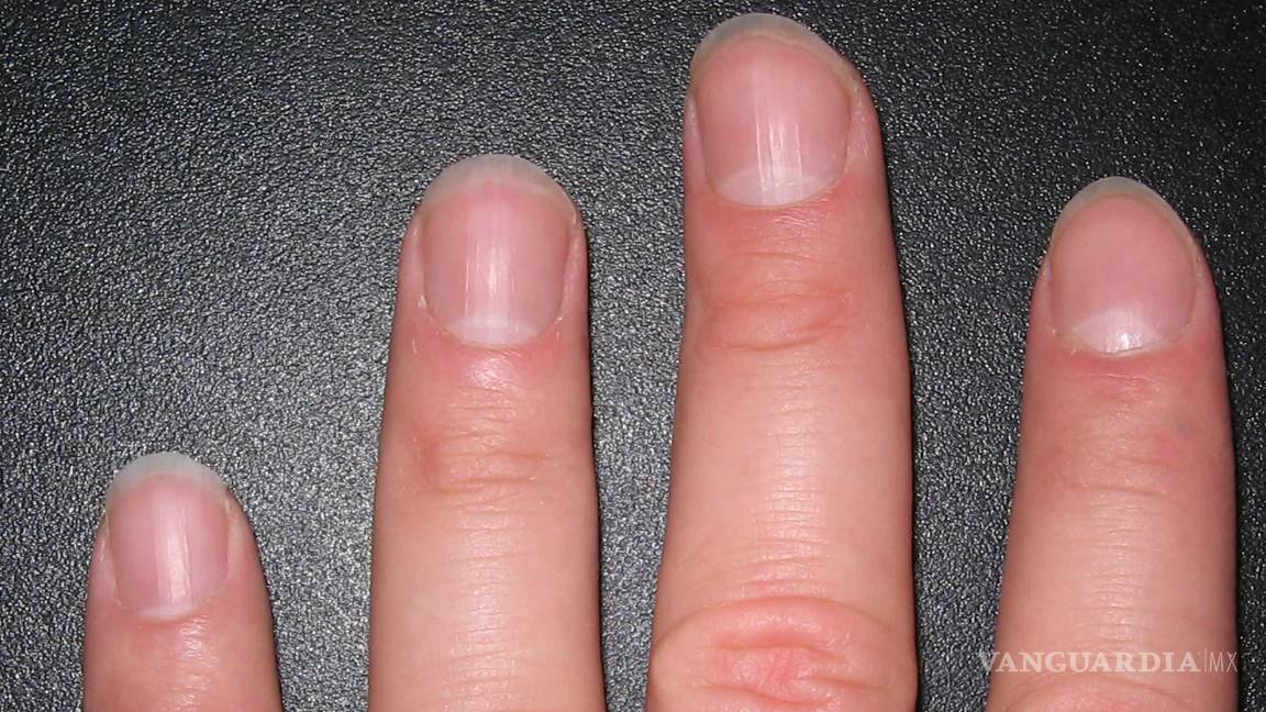 $!Los 7 problemas de uñas más frecuentes y cómo evitarlos