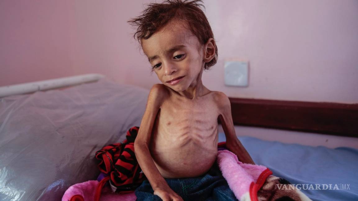 $!Según Save the Children, el hambre habría matado a 85 mil niños en Yemen