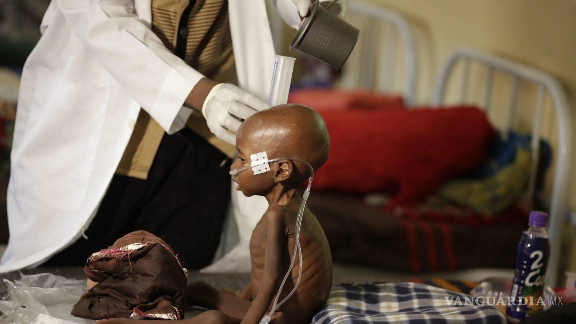 Más de 100 muertos en Somalia a causa de hambruna y sequía