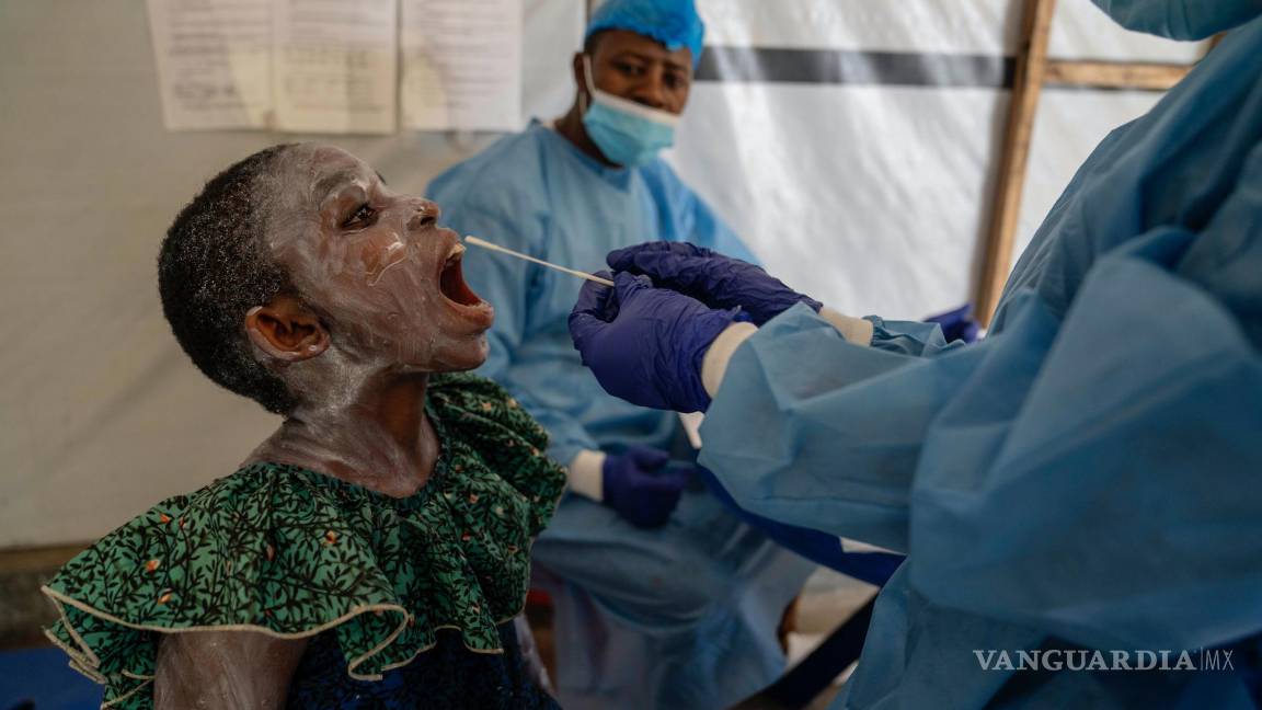 $!Un trabajador sanitario toma una muestra de saliva a Lucie Habimana, de 13 años con viruela símica, en un centro de tratamiento en Munigi.