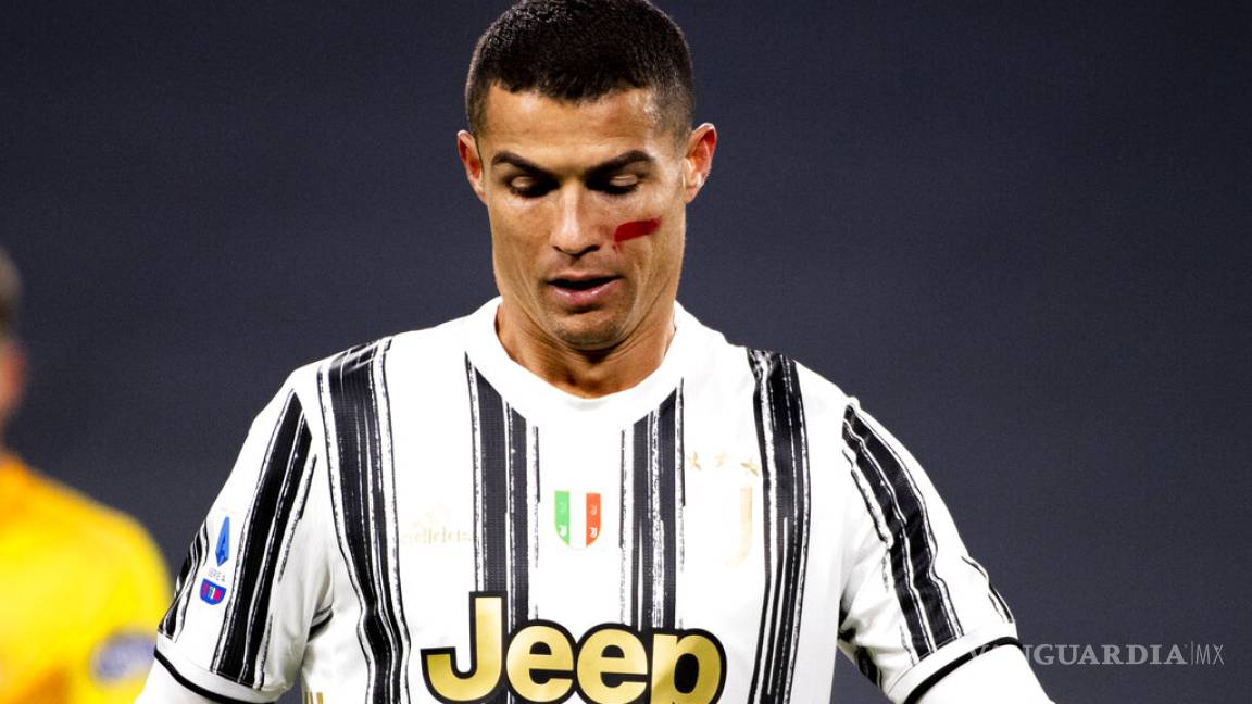 Jugadores de la Serie A se marcan contra la violencia de género