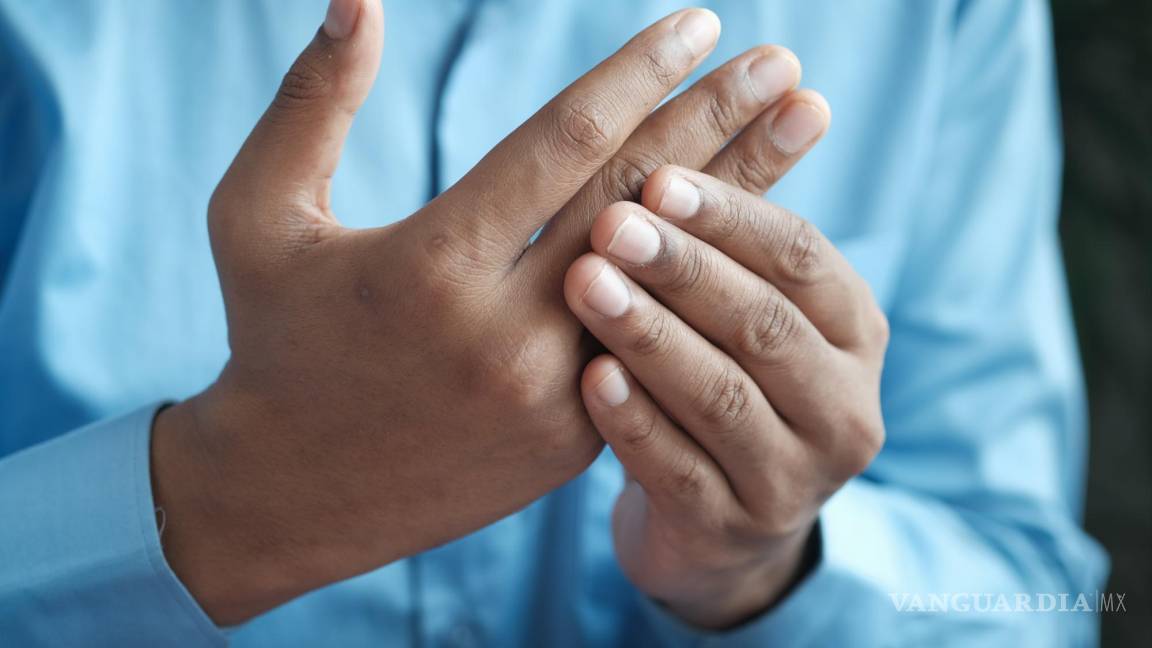¿Se puede prevenir la artritis?