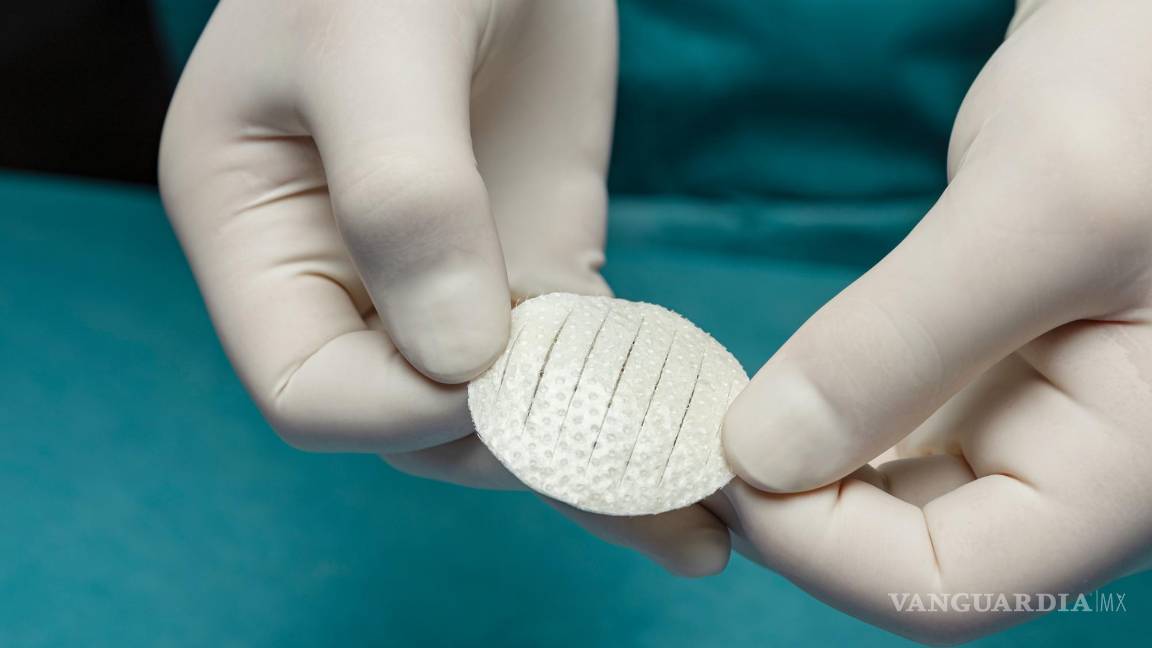 $!Producto que combina injertos de piel de pescado y silicona.