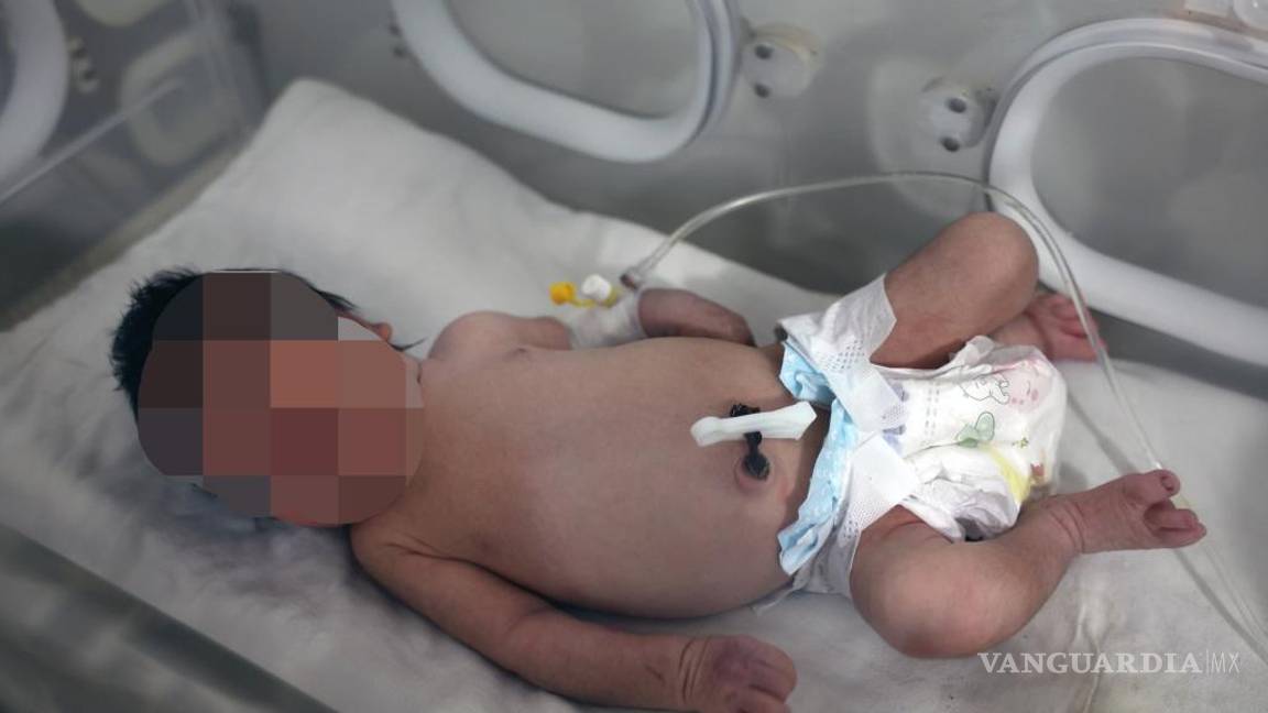 $!Una niña que nació bajo los escombros causados por un terremoto que azotó a Siria y Turquía recibe tratamiento en un hospital en Afrin, provincia de Alepo, Siria.