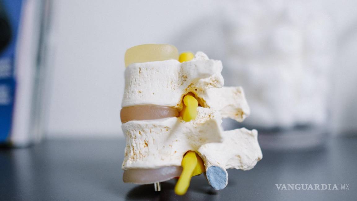 $!No es imposible evitar la artritis mientras envejecemos, afirmó Kelli Dominick Allen, fisióloga del ejercicio en la Escuela de Medicina de la Universidad de Carolina del Norte.