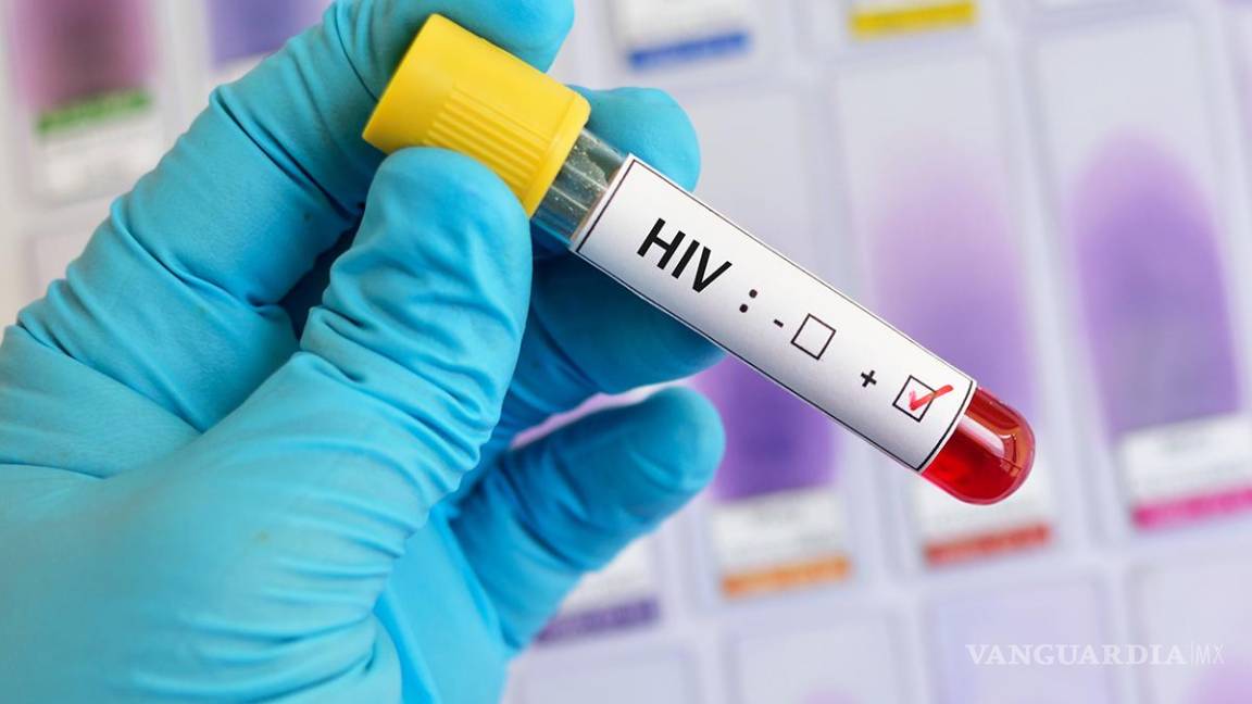Detectan 36 nuevos casos de VIH en Coahuila