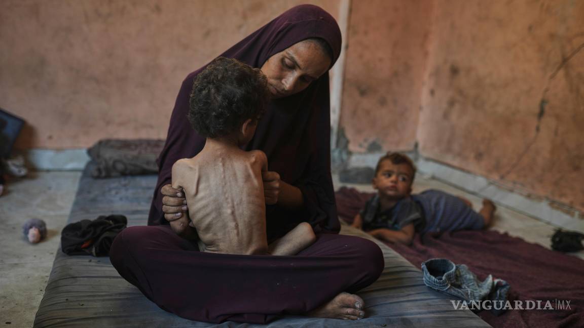 $!Naima Abu Ful con su hijo de 2 años, Yazan, que está desnutrido, en el campamento de refugiados de Shati en Ciudad de Gaza, el 23 de julio de 2025.