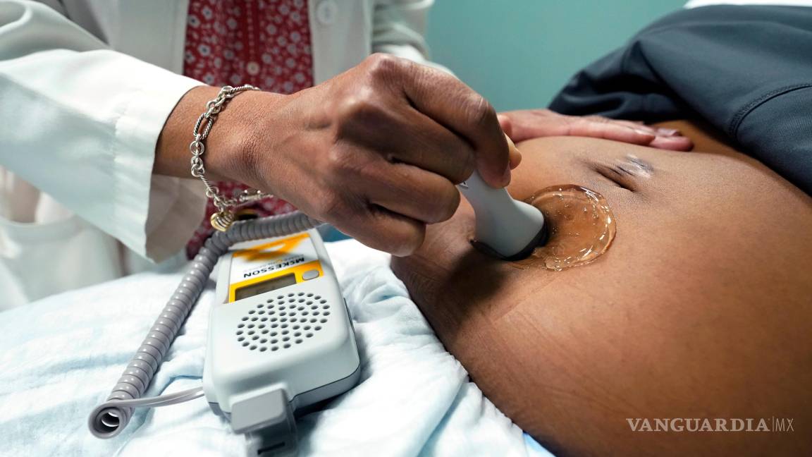 $!Un médico utiliza una sonda Doppler manual en una mujer embarazada para medir los latidos del corazón del feto en Jackson, Mississippi.