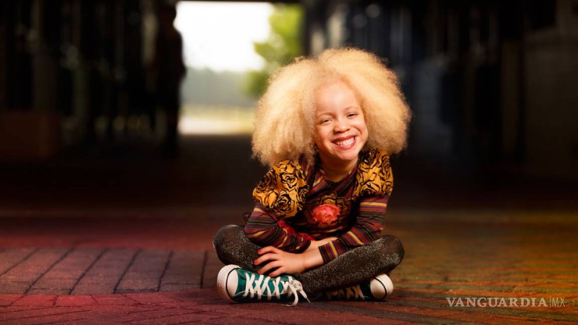 Niña albina revoluciona el mundo de la moda
