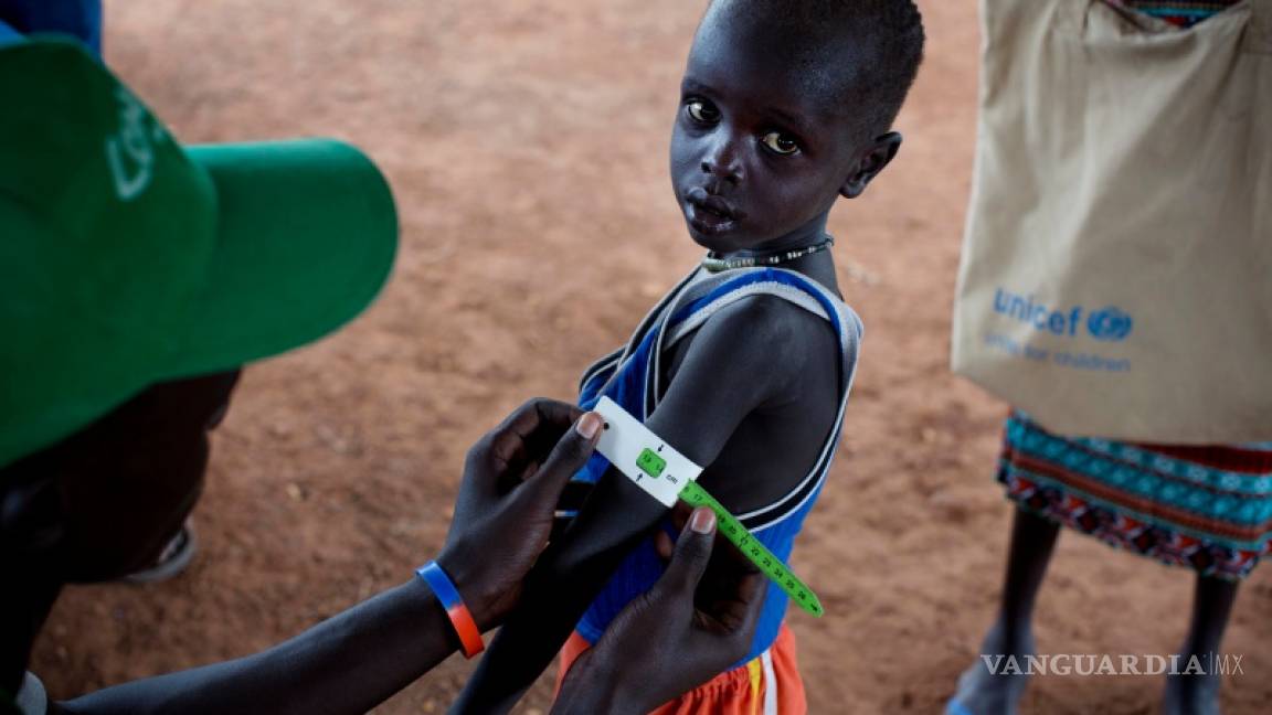 Unicef: Casi 1.4 millones de niños amenazados por la hambruna
