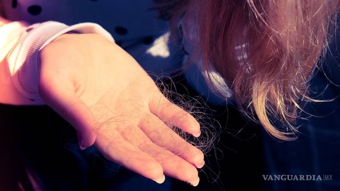 $!Uno de los síntomas frecuentes de la diabetes es la caída de cabello. EFE/Hospital Capilar
