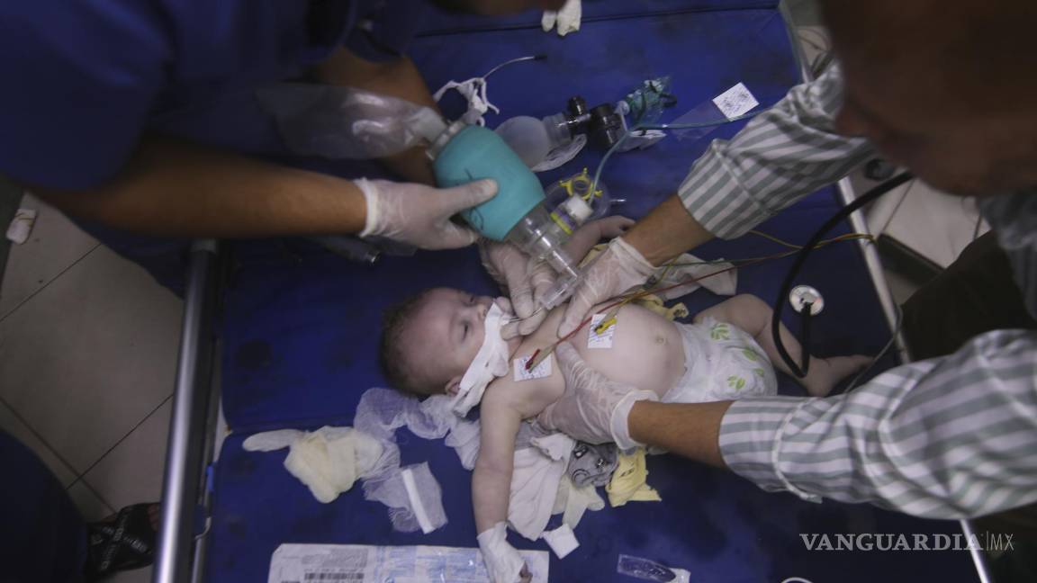$!Un bebé palestino herido por bombardeos de Israel es atendido en el hospital de Al-Najar, en Rafah, Franja de Gaza.